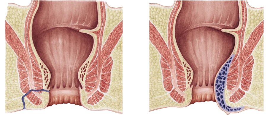 Best Proctologist Surgeon in Faridabad