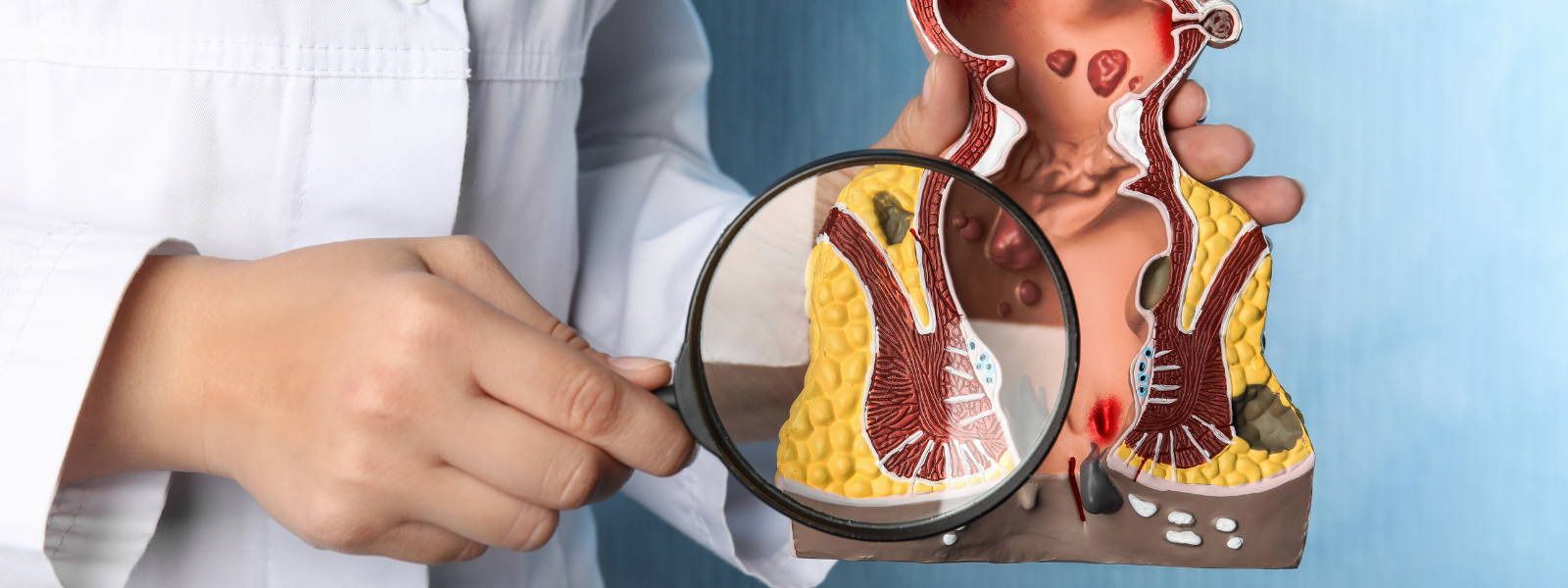 Laser Treatment For Fistula in Faridabad